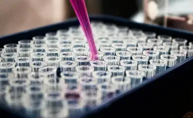 Teste de sangue pode revolucionar diagnóstico da doença de Alzheimer. Foto: Louis Reed/ Unsplash